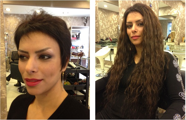 Saç kaynağı öncesi ve sonrası
