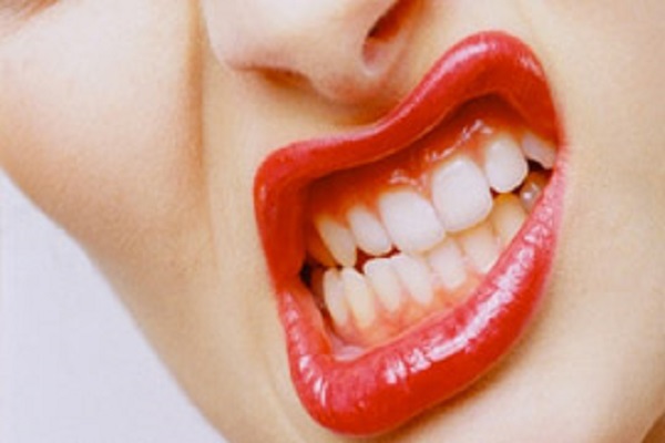 diş sıkma alışkanlığı